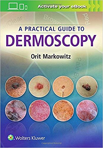 A Practical Guide to Dermoscopy  2017 convert to PDF - پوست